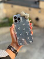 قاب پاپیون لاکچری آیفون و سامسونگ و شیائومی (کدC1935) - تصویر 5